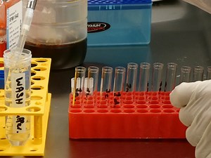 Temporal Tracking of Cell Cycle Progression Using Flow Cytometry without the Need for Synchronization
