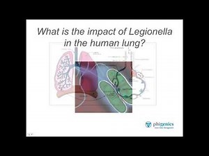 Ask the Expert - Part 5: What is Legionella's impact on health?