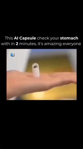 The Unfold (Global 🌎) | Ai capsule... AI Capsule check your stomach within 2 minutes...... A new AI-powered capsule endoscopy system can perform a stomach exam in... | Instagram