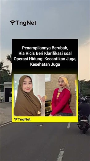 Ria Ricis Beri Klarifikasi soal Operasi Hidung: Kecantikan Juga, Kesehatan Juga