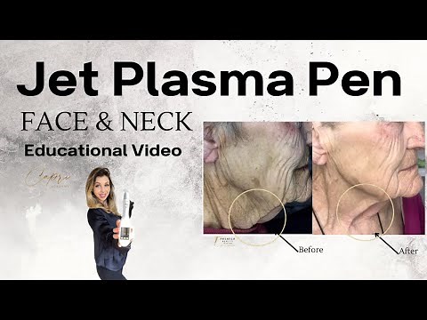 Jet Plasma Pen Face & Neck Skin Tightening