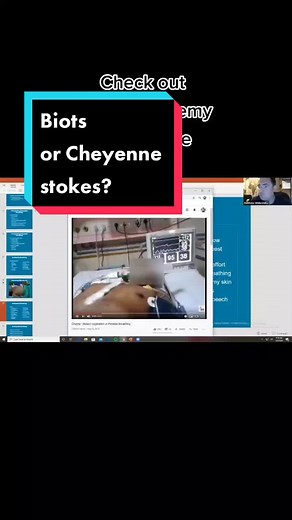 Biots vs cheynne stokes respirations #emt #ems #paramedic #nursing #fypシ