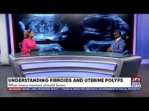 Understanding Fibroid and Uterine Polyps: What every woman should know
