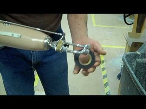 Trans-Radial Amputee