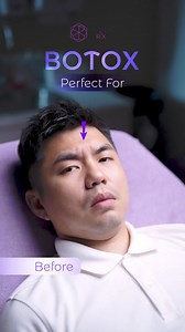 ✨ Check out this quick reel to see how Botox can help erase wrinkles while maintaining a natural look! 🌟 Not only will you look refreshed, but your face can also be slimmed by injecting it into your masseter. 💉 This treatment is popular for both women and men, especially since men have stronger muscles that contribute to more pronounced wrinkles. See the amazing after-results: younger, smoother, and completely natural! 😊 | Clinic RX