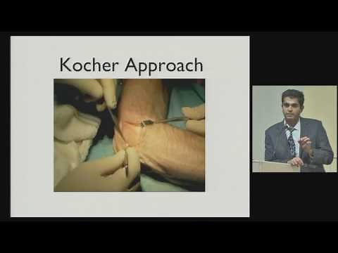 Dr Jairam Jagiasi (HOD Orthopaedics)-Surgical Approaches to the Elbow