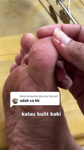 Azalea Smooth Foot Cream untuk Kaki Pecah-Pecah