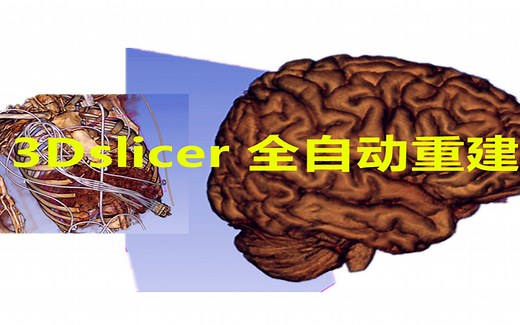用3DSlicer全自动建立三维模型当载入DICOM数据适合颅内肿瘤及动静脉三维模型胸部骨骼等模型支持代码定制