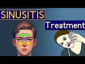Sinusitis Explained: signs symptoms and treatment. How to beat chronic sinusitis