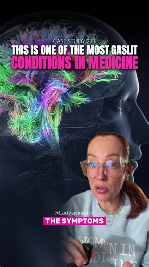 Understanding Functional Neurological Disorders: A Case Study