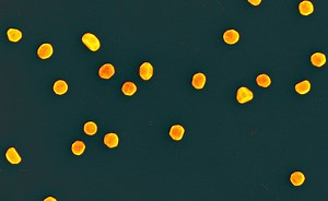 Gold Nanoparticles Destroy Cancer in Mice | Cell And Molecular Biology