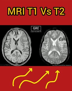 232K views · 2.6K reactions | MRI T1 Vs T2 | CT Scan and MRI study | Facebook