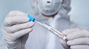 How accurate are COVID-19 results?