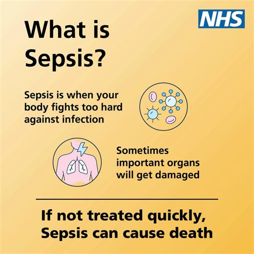 🩸 Sepsis is a life-threatening reaction to infection. Act fast if you notice: • Slurred speech or confusion • Extreme shivering or muscle pain • Passing little or no urine • Severe breathlessness • Skin mottled, bluish, or very pale These symptoms require immediate medical attention. Learn more: https://ow.ly/6JX050WVGSc https://ow.ly/r7Ub50WVGSt #WorldSepsisDay | Salisbury Walk In Centre