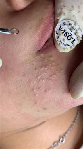 Hướng Dẫn Chăm Sóc Da Tại Spa LQ