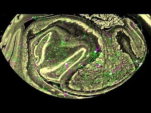 The Human Brain: Images to Atoms