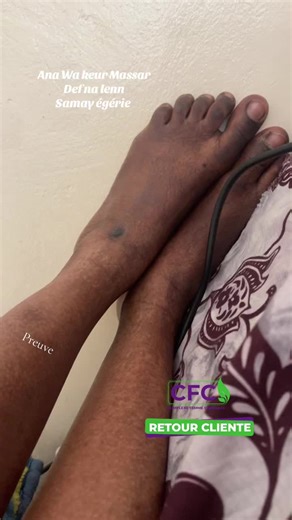 CFC: The Ultimate Solution for Skin Care