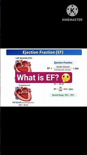 #Ejection Fraction (EF)#Normal vs Low EF# basic Echocardiogram