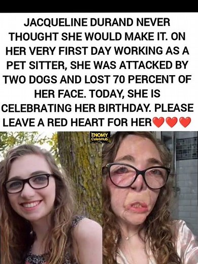 Jacqueline Durand's Birthday Today After Surviving a Brutal Dog Attack That Took 70% of Her Face💔💔