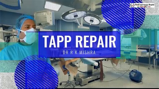 Easiest Way of Performing Laparoscopic Inguinal Hernia Repair Using Less Expensive Mesh