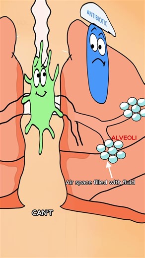 Why antibiotics suddenly stop working #animation #healthtips