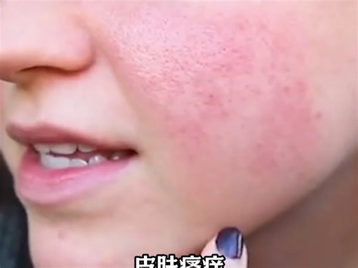 原来那些皮肤好的人都在用这个！