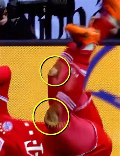 Players vs Knee Slide + KID