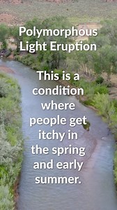 Are you suffering from itchy skin in the spring or summer? You may have PMLE (polymorphous light eruption). For more information contact Dr. Matt Innes at Tanner Clinic in Layton Utah. #pmle #polymorouslighteruption #itchyskin #summer #skindoctor #skincare #doctor #medicaldoctor #md #dermatology #dermatologist | Tanner Clinic