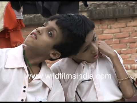 Conjoined twin girls in India at family home | Twins playing with sisters