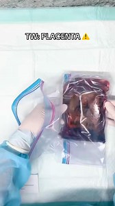 3.6K views · 109 reactions | Nationwide placenta processing &...