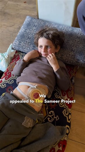 The Sameer Project on Instagram: "Remember little Hamdan whose only wish was to be able to play like normal children his age? Instead he is bedridden much of the time after intestinal surgery, in need of colostomy bags, which the family does not have the funds to purchase. We already showed you our team revisiting Hamdan and his family. Installing a tent after theirs was destroyed in the rain. Providing blankets and jackets for warmth. Here we are again retuning to Hamdan with proper nutritional