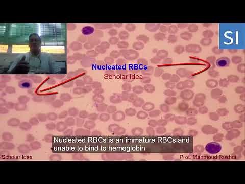 Nucleated red blood cells in the peripheral circulation !!!