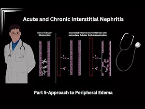 Interstitial Nephritis- Acute and Chronic Interstitial Nephritis
