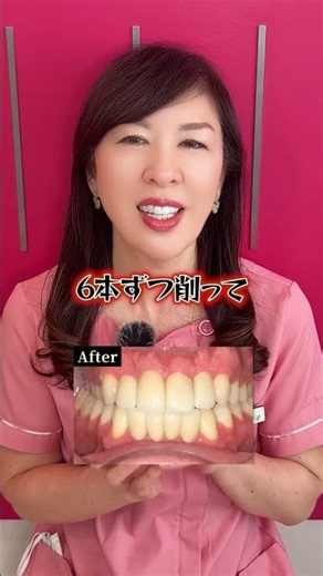 顔と歯の形って関係あるの知っていますか？ #アイエスデンタルクリニック #歯医者 #審美治療