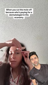 8.6K views · 89 reactions | Cutting off a mole yourself isn’t as...