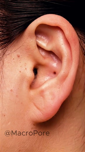 EXTREME Macro Ear Extraction 🤯 Watch the Vacuum Work #macro #asmr