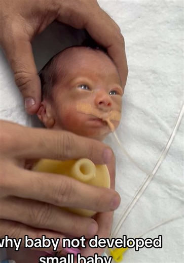 Understanding Baby Development Challenges