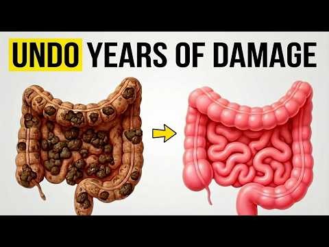 Gut Detox: How To Repair & Clean Your Gut Naturally