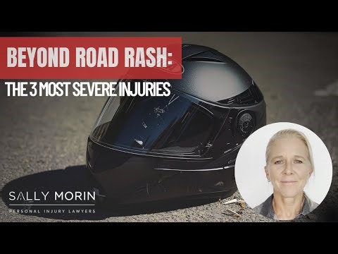 Beyond Road Rash: The 3 Most Severe Motorcycle Injuries