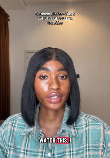 Effective Solutions for Dark Knuckles Problems