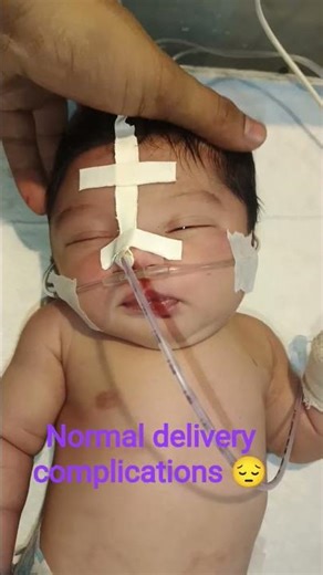 Normal delivery complications😔😔#hospital#nicucare#nicu#newborn#youtubeshorts#shorts#youtube