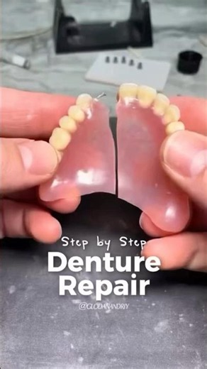 Denture repair step by step #dentist