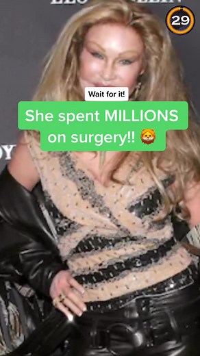 The Bizarre World of Plastic Surgery Transformations