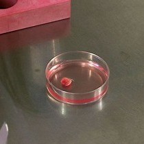 Video: Lineage-reprogramming of Pericyte-derived Cells of the Adult Human Brain into Induced Neurons