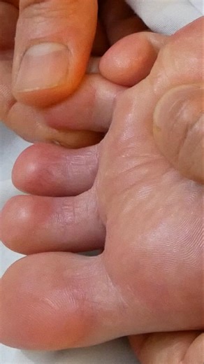 Foot Massage ASMR Best Moments #softspokenasmr #sleepasmr #shorts