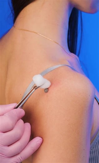 No Secrets Here! A True Glimpse into the World of Surgery | 5-Minute Workouts