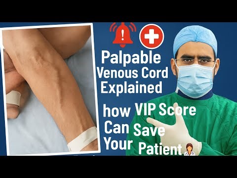 🔥 “Palpable Venous Cord Explained 🩺 | how VIP Score Can Save Your Patient 🚨👩‍⚕️”. #medical#viral
