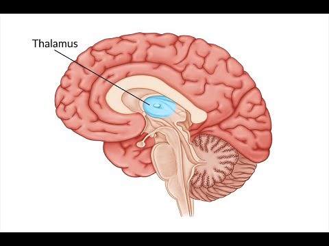 Thalamic Stroke