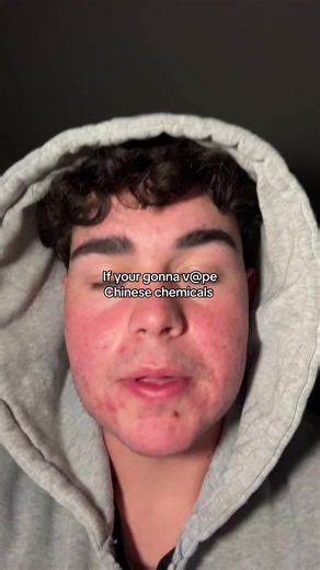 Might as well #looksmax #looksmaxing