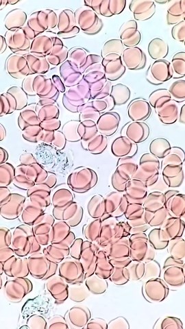 BBC Earth on Instagram: "Human blood under the microscope 🔬 Human blood is made up of four main components – red blood cells, white blood cells, plasma and platelets. #EarthCapture by @tardibabe . . . . #Science #Cells #Nature #Photography"